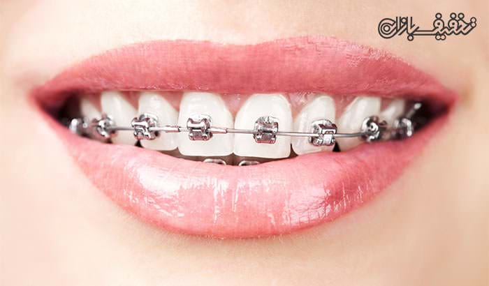 ارتودنسی دندان توسط متخصص در مطب دندانپزشکی مهتاب