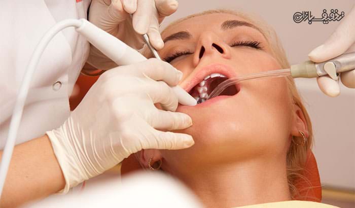 عصب کشی دندان (درمان ریشه) به همراه ترمیم با ۵۰ درصد تخفیف