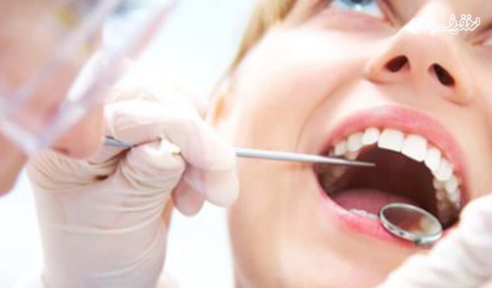 کشیدن دندان با ۵۰ درصد تخفیف