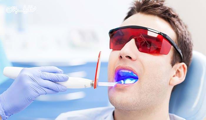 کوپن تخفیف ۵۰ درصدی ترمیم دندان
