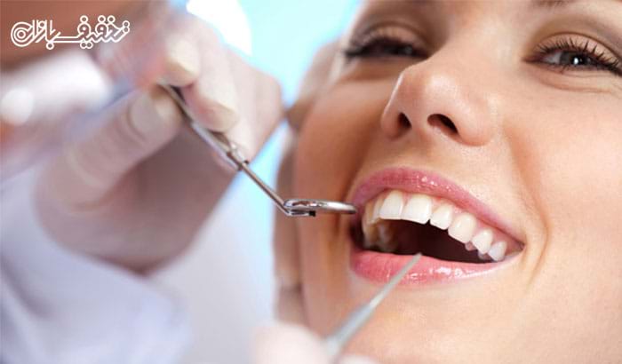 جرمگیری دندان همراه با بروساژ در مطب دندانپزشکی دکتر کامران افشین