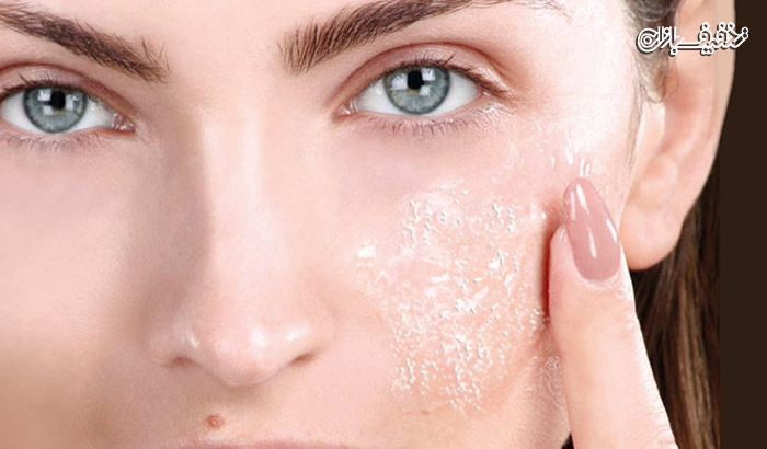 پاکسازی پوست (پیلینگ شیمیایی) همراه با میکرودرم آبریژن در سالن زیبایی تیهو