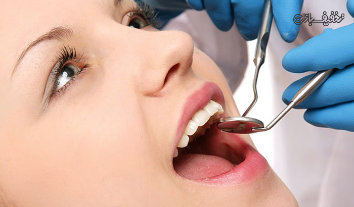 جرمگیری معمولی دندان در مطب دندانپزشکی دکتر اکبری 