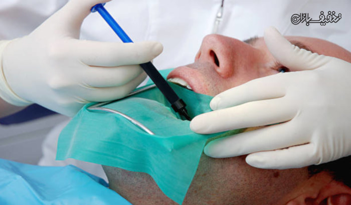 عصب کشی همراه با ترمیم دندان در مرکز دندانپزشکی عارف 