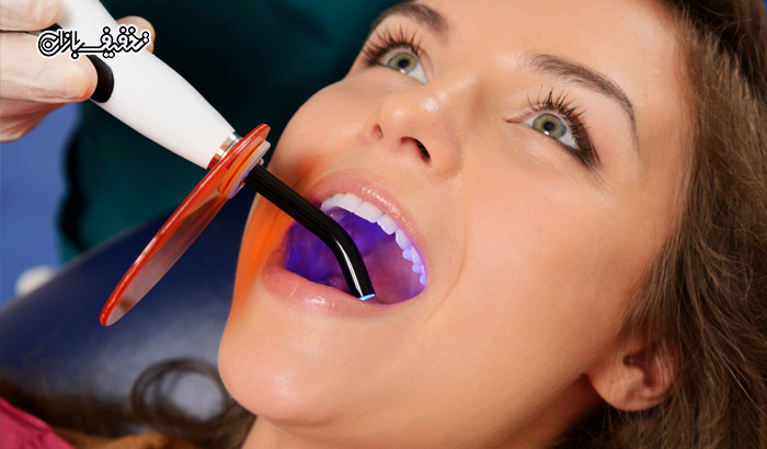 پر کردن و ترمیم دندان با استفاده از مواد کامپوزیت در مطب دندانپزشکی دکتر کامران فتحی