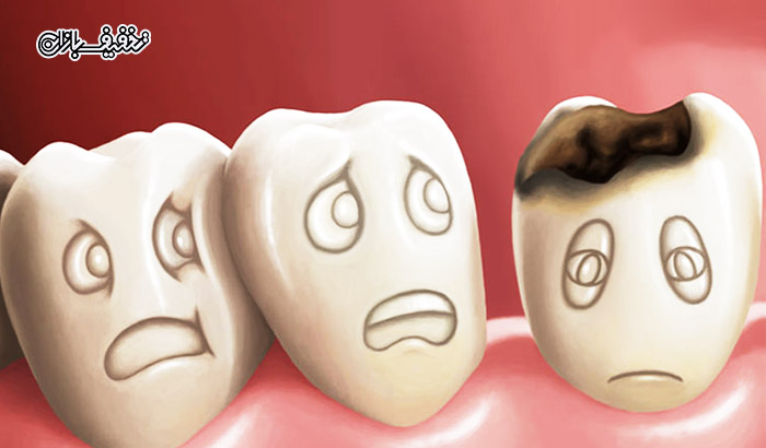 کشیدن دندان دائمی در مطب دندانپزشکی دکتر کامران فتحی