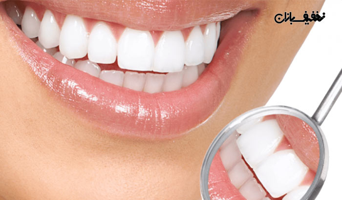 جرم گیری، سفید کردن و رفع بوی بد دهان و دندان در مرکز زیبایی آرامیس توسط دکتر مریم السادات علوی 