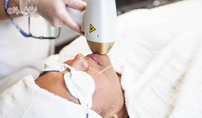 رفع موی زائد ویژه بانوان با دستگاه لیزر الکس پلاتینیوم 2019 در مطب دکتر خسروی فر