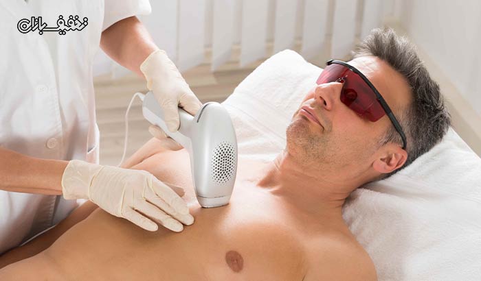 رفع موی زائد ویژه آقایان با دستگاه لیزر الکس پلاتینیوم 2019 در مطب دکتر خسروی فر