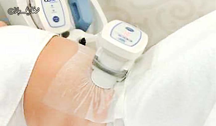 لاغری موضعی با دستگاه کرایولیپولیز cool shaping در مرکز تناسب اندام جوزدانی