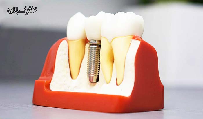 انواع خدمات دندان پزشکی در مطب دکتر آزادی