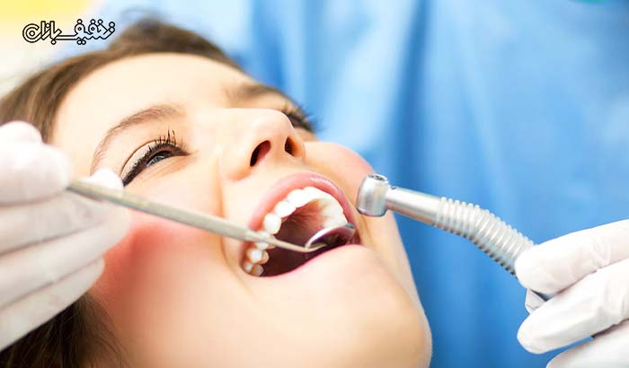 انواع خدمات دندان پزشکی در مطب دکتر آزادی