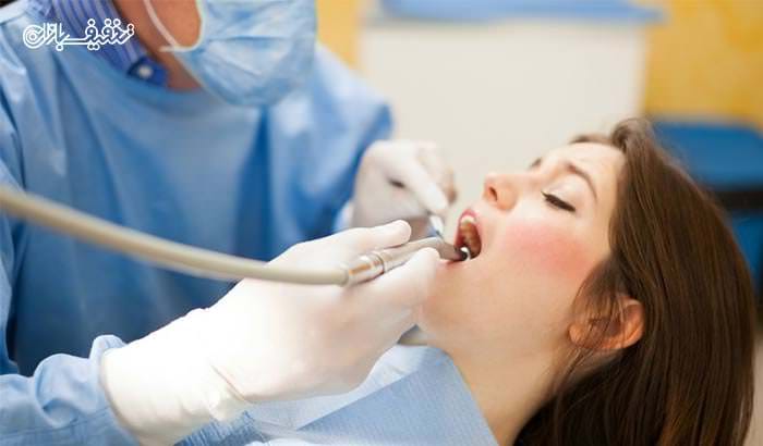 کوپن تخفیف ۵۰ درصدی عصب کشی دندان (درمان ریشه)