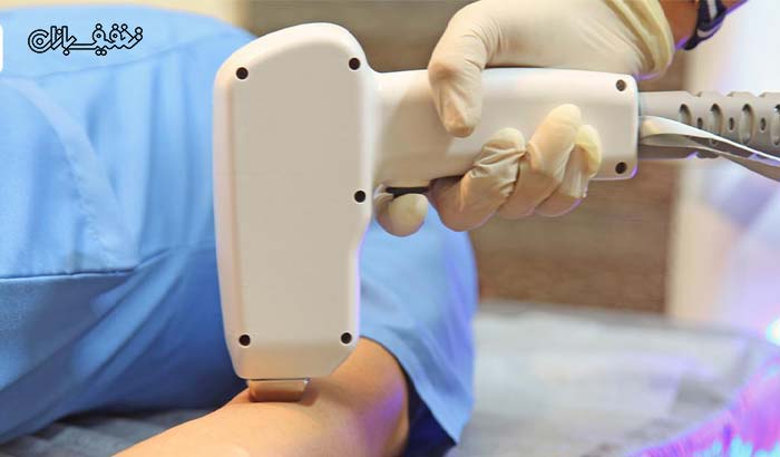 لیزر بدن با دستگاه الکس دایود اندیگ ۲۰۲۰ در کلینیک هیرا