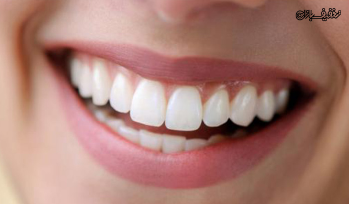دندان های سفید و سالم با ترمیم کامپوزیت در مطب دکتر بهاره مظهری