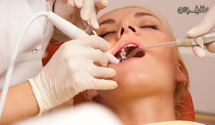 عصب کشی دندان (درمان ریشه) با ۴۰ درصد تخفیف طبق تعرفه سال ۹۴